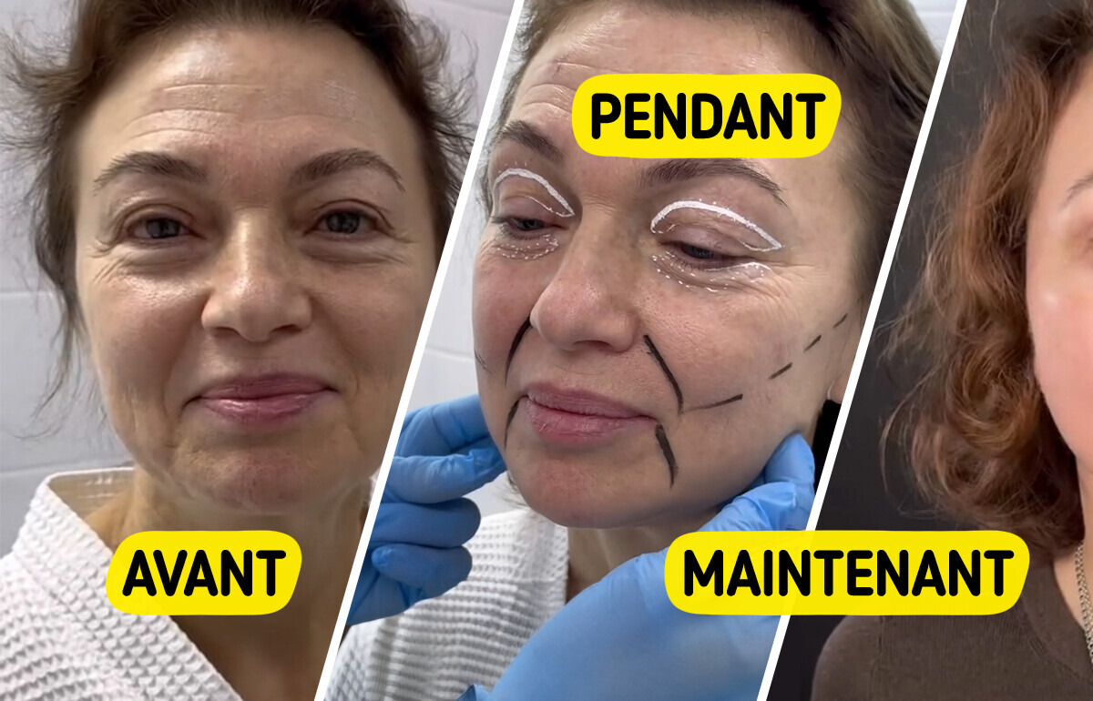 "Elle devra changer de passeport", une femme de 58 ans surprend tout le monde avec les résultats de son lifting "Elle devra changer de passeport", une femme de 58 ans surprend tout le monde avec les résultats de son lifting