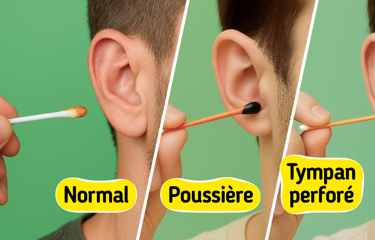 5 Couleurs de cérumen qui peuvent révéler un problème de santé 5 Couleurs de cérumen qui peuvent révéler un problème de santé