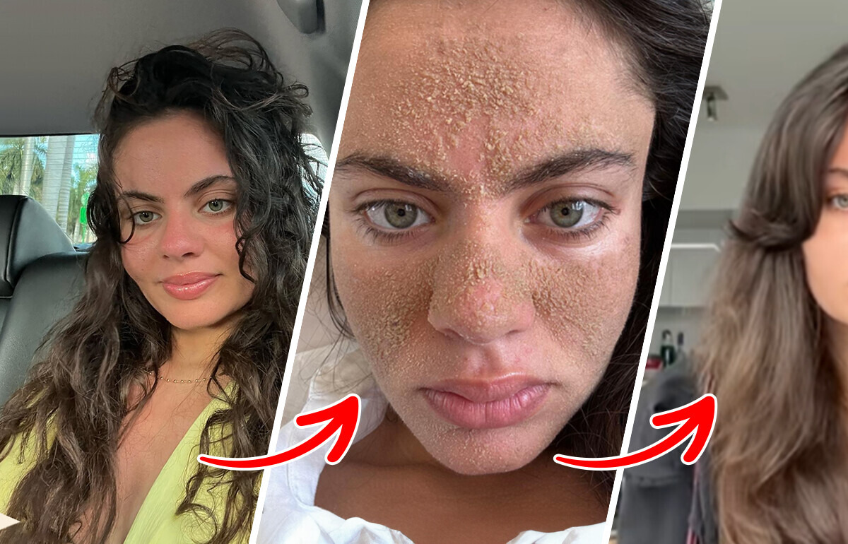 Elle ne lave plus son visage depuis plus d’un mois et sa transformation choque les internautes Elle ne lave plus son visage depuis plus d’un mois et sa transformation choque les internautes
