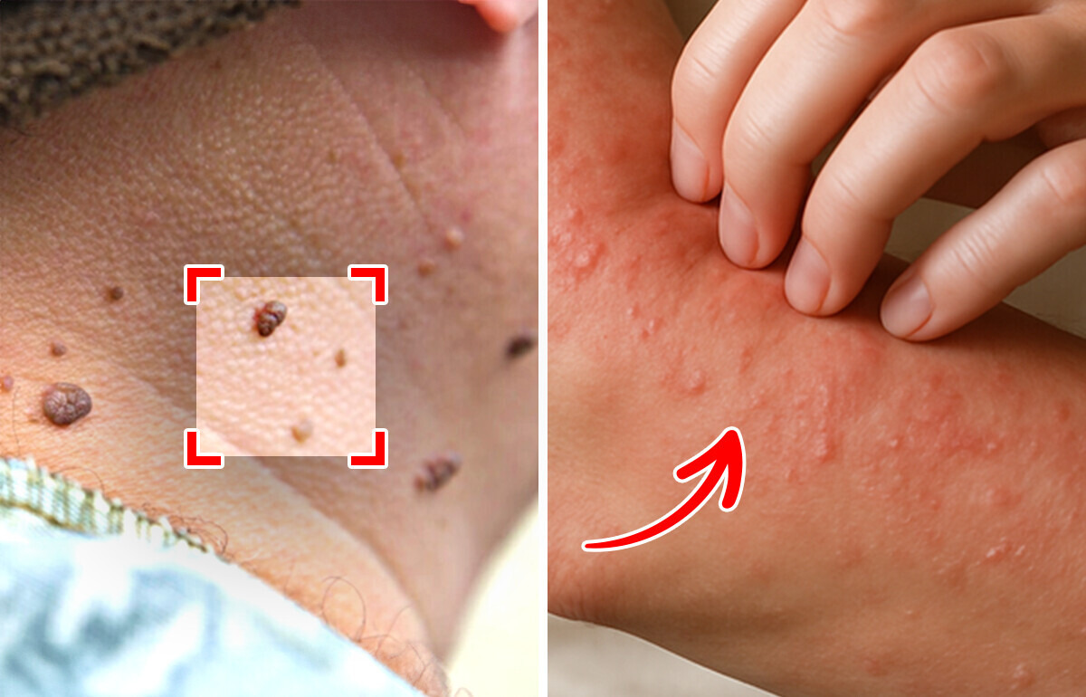 6 Symptômes sournois du diabète que tu pourrais ne pas remarquer 6 Symptômes sournois du diabète que tu pourrais ne pas remarquer