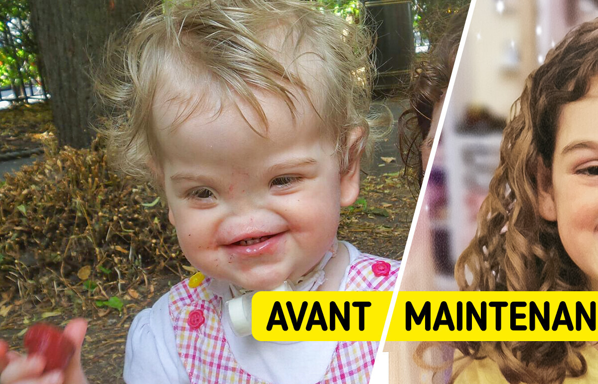 Une fille née sans nez, que l'on appelait "Voldemort", a prouvé que chacun est beau à sa manière