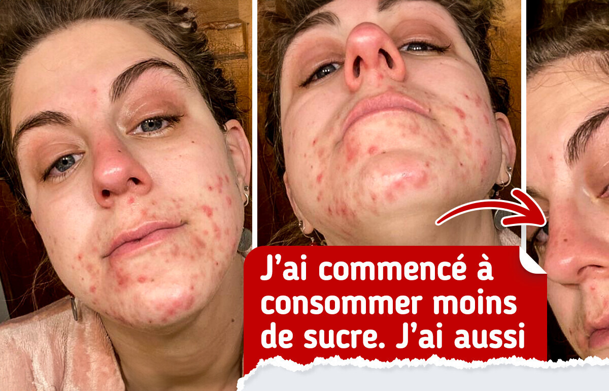 20+ Photos “avant” et “après” qui révèlent des changements à couper le souffle