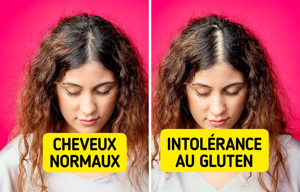 13 Signes méconnus que ton corps ne tolère pas le gluten 13 Signes méconnus que ton corps ne tolère pas le gluten