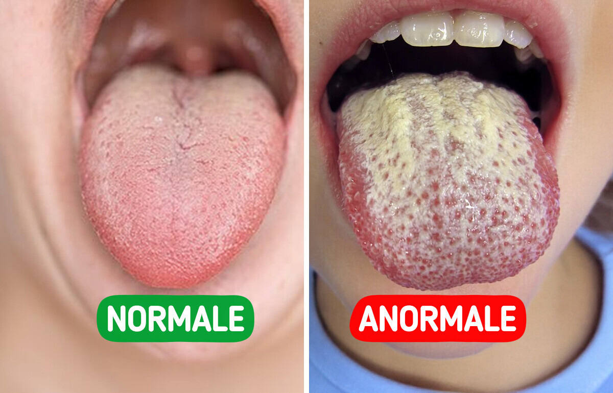 Pourquoi ta langue devient blanche et comment la traiter naturellement Pourquoi ta langue devient blanche et comment la traiter naturellement