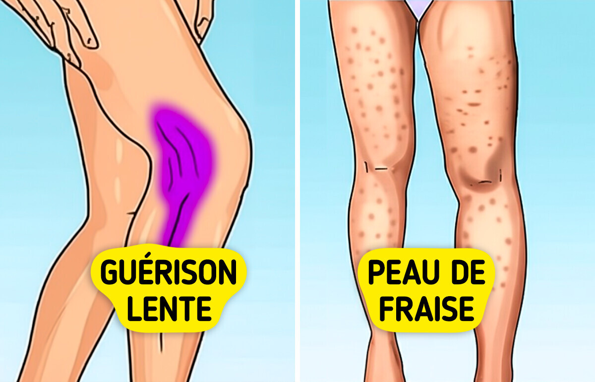 7 Signes que ton corps peut te donner lorsque tu manques de collagène 7 Signes que ton corps peut te donner lorsque tu manques de collagène