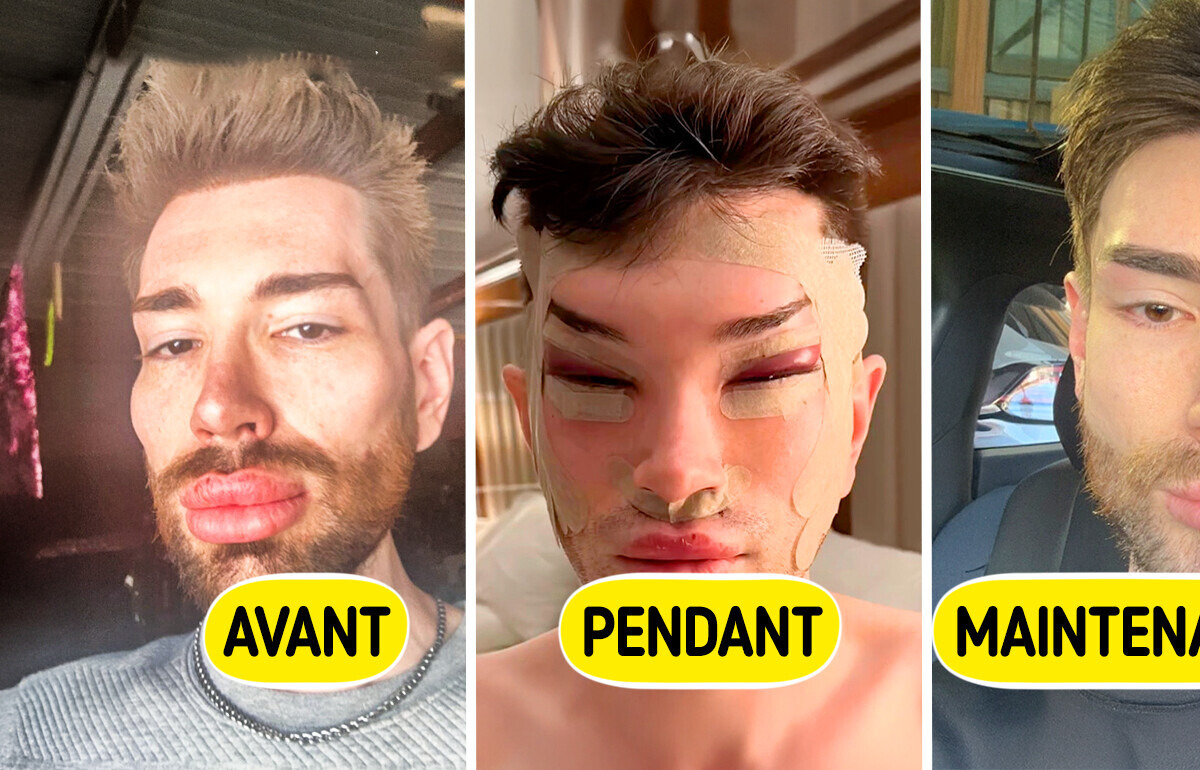 Un homme choque les internautes avec sa transformation physique drastique Un homme choque les internautes avec sa transformation physique drastique