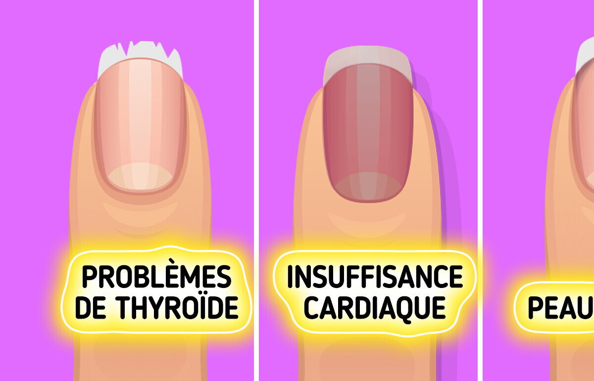 Tes ongles peuvent t’alerter sur ta santé avant que tu ne ressentes quoi que ce soit