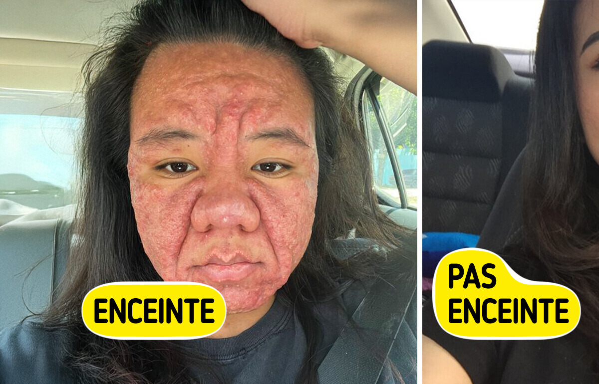 Une jeune femme de 28 ans parle sans filtre des changements physiques dus à la grossesse Une jeune femme de 28 ans parle sans filtre des changements physiques dus à la grossesse