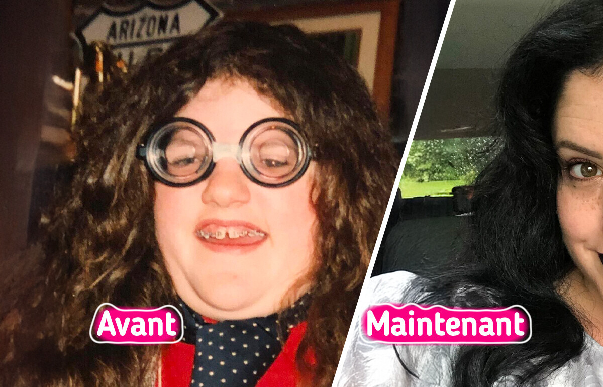 16 Personnes partagent des photos saisissantes qui montrent à quoi ressemble un vrai changement