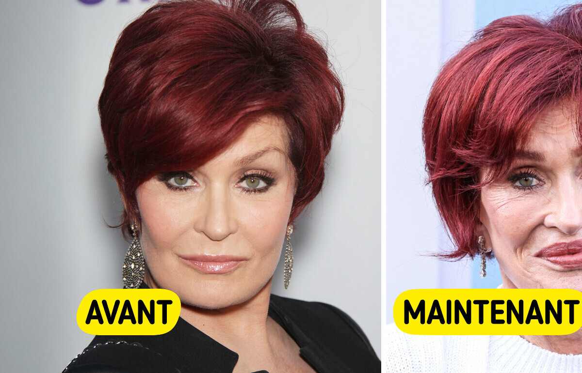 “Je crois que je suis allée trop loin” : à 72 ans, Sharon Osbourne révèle enfin la vérité sur sa transformation “Je crois que je suis allée trop loin” : à 72 ans, Sharon Osbourne révèle enfin la vérité sur sa transformation