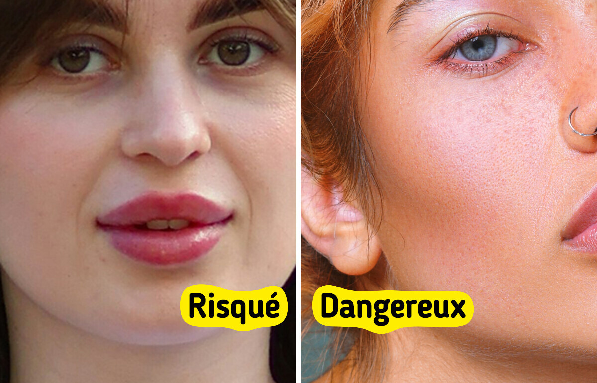 10 Procédures esthétiques qui ne sont pas aussi inoffensives qu’on le croit 10 Procédures esthétiques qui ne sont pas aussi inoffensives qu’on le croit