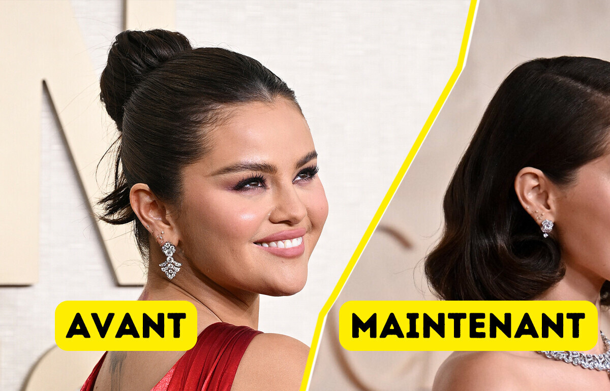 "Elle a fait des injections et posé un implant à la mâchoire", le nouveau look de Selena Gomez suscite des spéculations "Elle a fait des injections et posé un implant à la mâchoire", le nouveau look de Selena Gomez suscite des spéculations