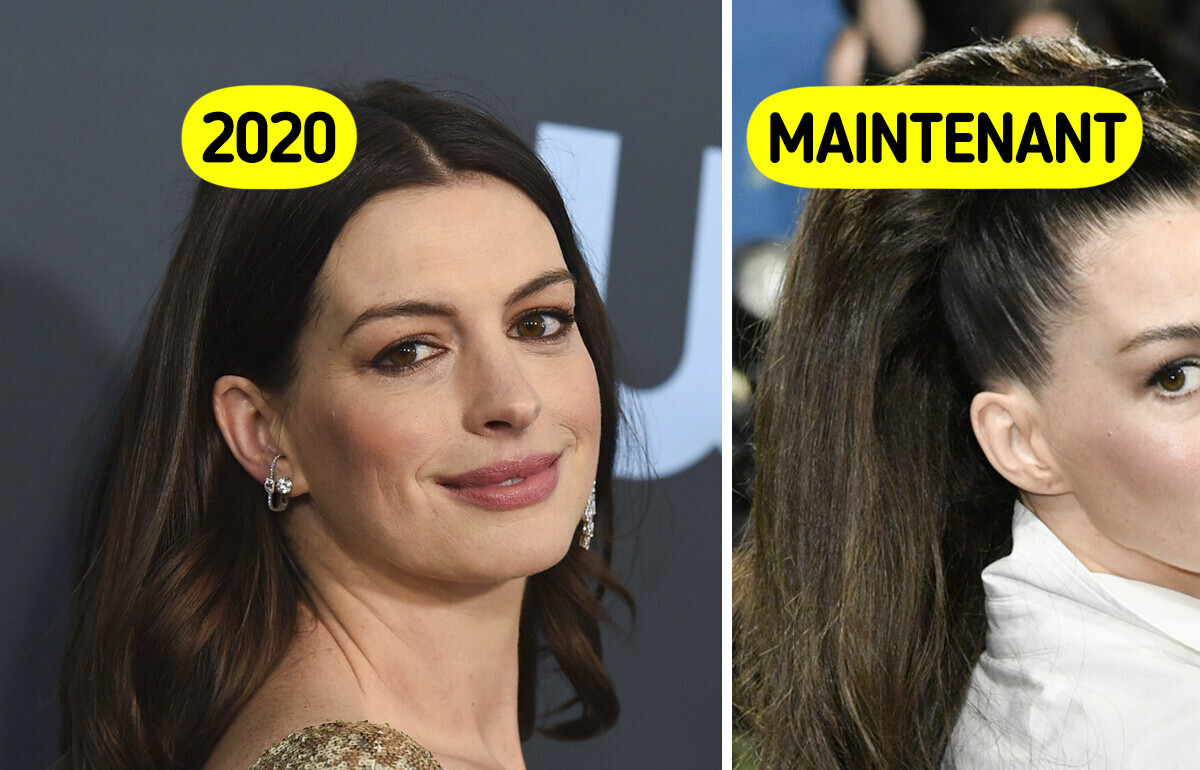 Anne Hathaway méconnaissable sur ces dernières photos : son nouveau look fait le buzz Anne Hathaway méconnaissable sur ces dernières photos : son nouveau look fait le buzz