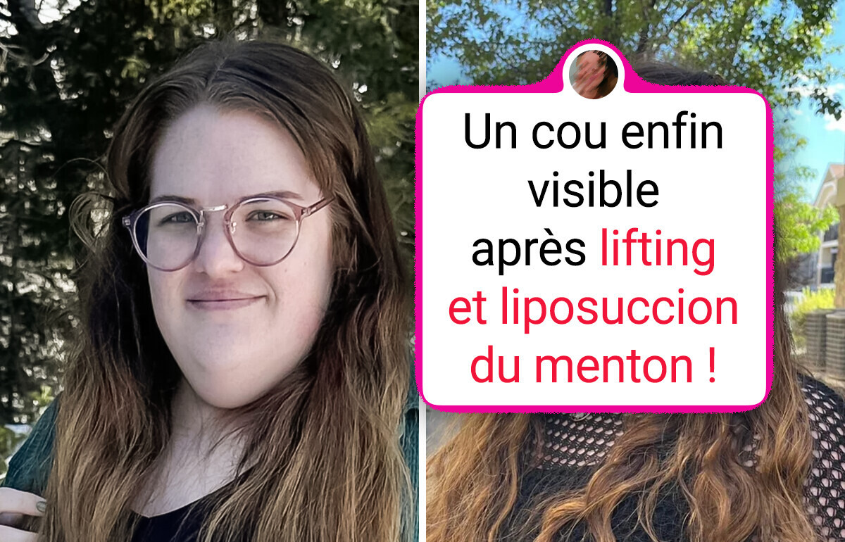 20+ Photos avant/après qui montrent combien l'apparence peut drastiquement changer