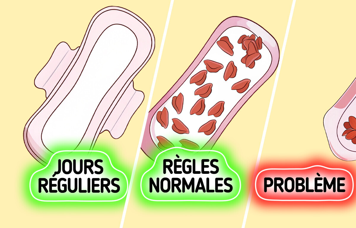 10 Symptômes alarmants qui pourraient cacher une endométriose 10 Symptômes alarmants qui pourraient cacher une endométriose