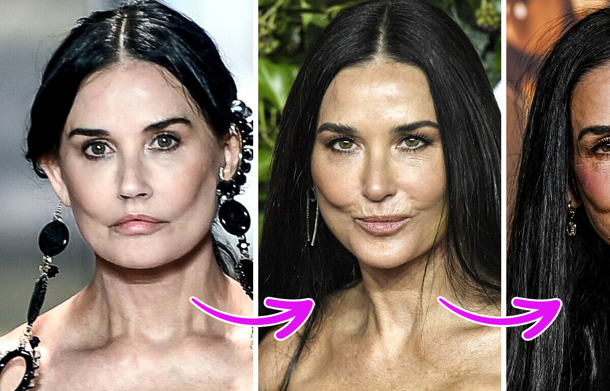 Des experts expliquent ce qui est arrivé au visage de Demi Moore