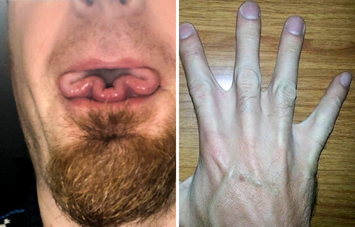 14 Traits physiques rares qui rendent ces personnes vraiment uniques