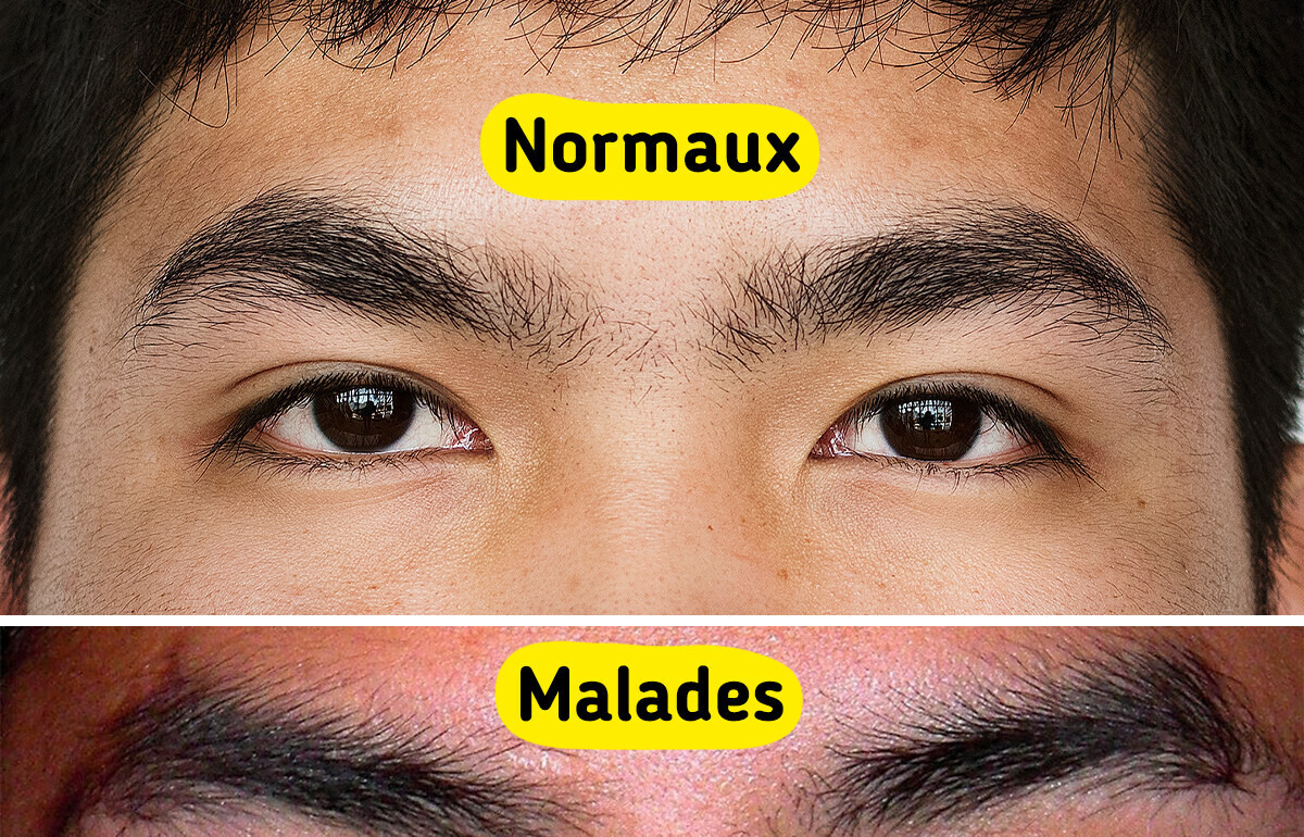 9 Signes dans tes yeux qui peuvent révéler un souci de santé