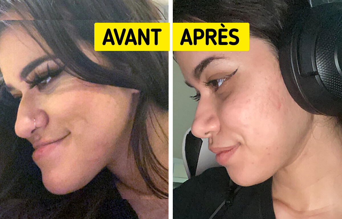 15 Personnes qui ont transformé leur apparence grâce à la chirurgie esthétique 15 Personnes qui ont transformé leur apparence grâce à la chirurgie esthétique