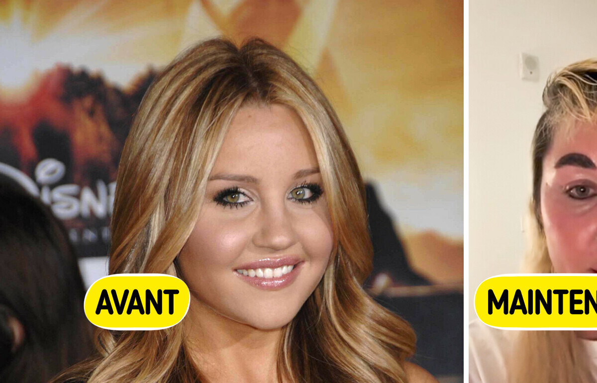 Le changement radical de look d’Amanda Bynes inquiète ses fans Le changement radical de look d’Amanda Bynes inquiète ses fans