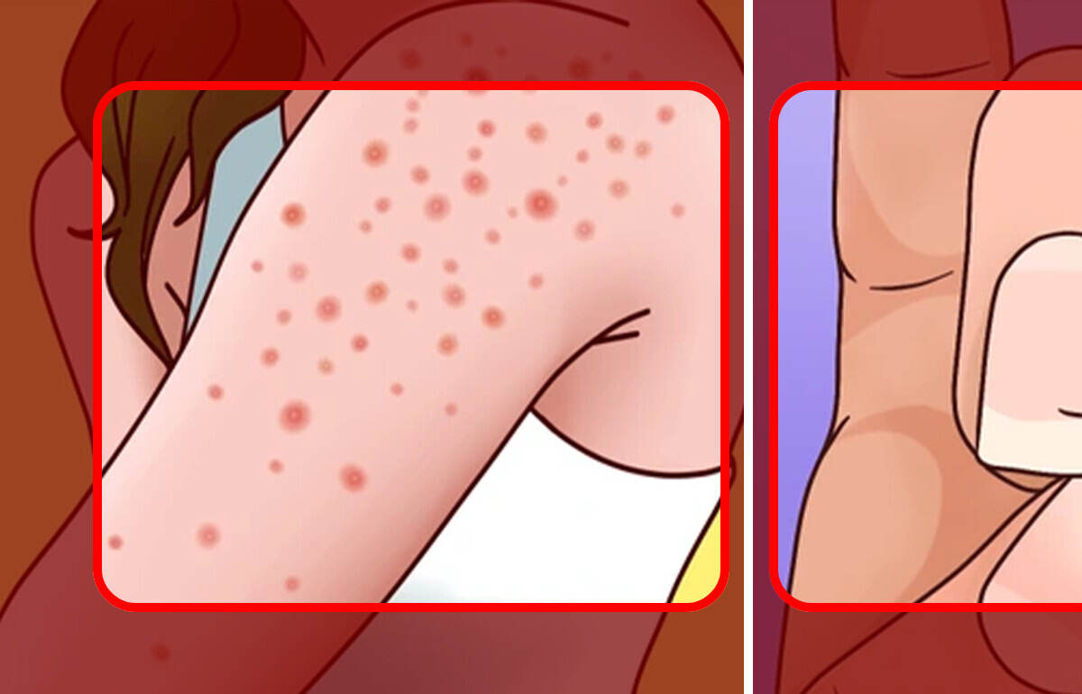 10 Signes alarmants qui pourraient révéler un problème de santé 10 Signes alarmants qui pourraient révéler un problème de santé