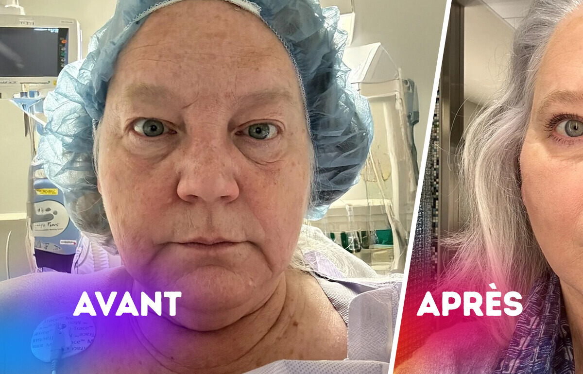 16 Personnes qui ont franchi le pas de la chirurgie et ne le regrettent pas du tout