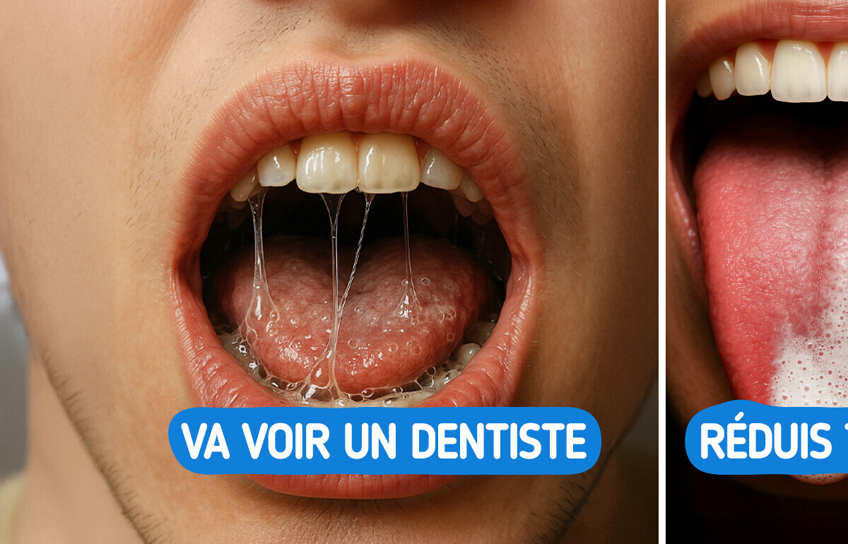 5 Indices discrets que ta salive révèle sur ta santé et qu’il ne faut pas ignorer 5 Indices discrets que ta salive révèle sur ta santé et qu’il ne faut pas ignorer