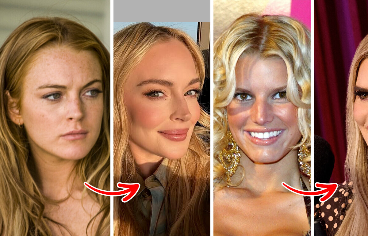 15 Stars devenues méconnaissables avec le temps 15 Stars devenues méconnaissables avec le temps