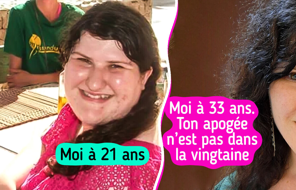 Ces photos qui célèbrent les métamorphoses les plus inattendues