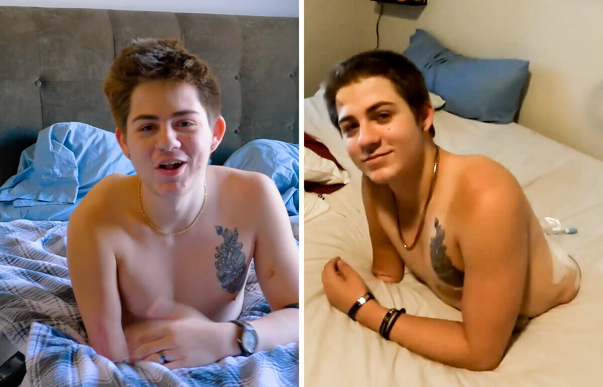 Un homme coupé en deux survit contre toute attente et inspire des millions de personnes