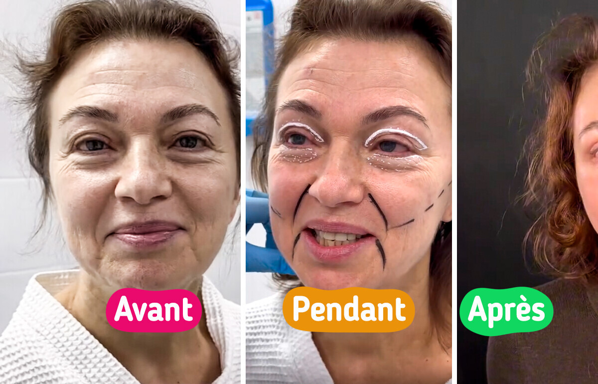 À 58 ans, une femme laisse tout le monde sans voix après un lifting spectaculaire : “Elle doit changer de passeport” À 58 ans, une femme laisse tout le monde sans voix après un lifting spectaculaire : “Elle doit changer de passeport”