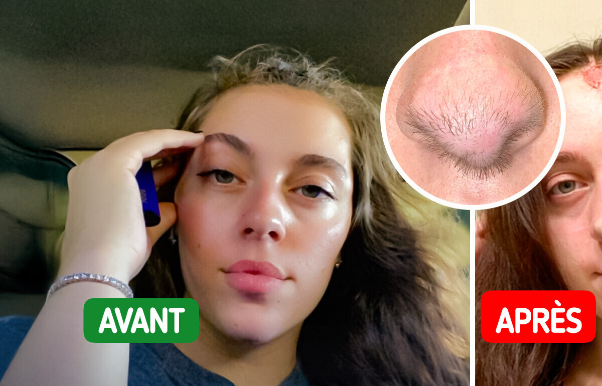 Elle est mordue par son chien, puis un phénomène incroyable commence à apparaître sur son visage Elle est mordue par son chien, puis un phénomène incroyable commence à apparaître sur son visage