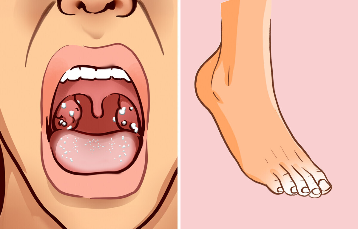 7 Façons surprenantes dont ton humeur peut perturber ton corps 7 Façons surprenantes dont ton humeur peut perturber ton corps