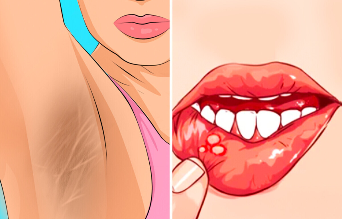 10+ Signes que ton corps t'envoie pour t'alerter de problèmes de santé 10+ Signes que ton corps t'envoie pour t'alerter de problèmes de santé