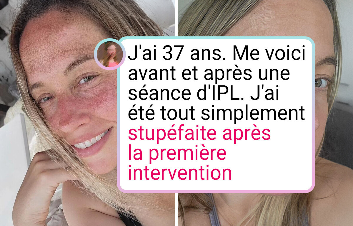 19 Photos avant et après qui montrent clairement ce qu’est le changement