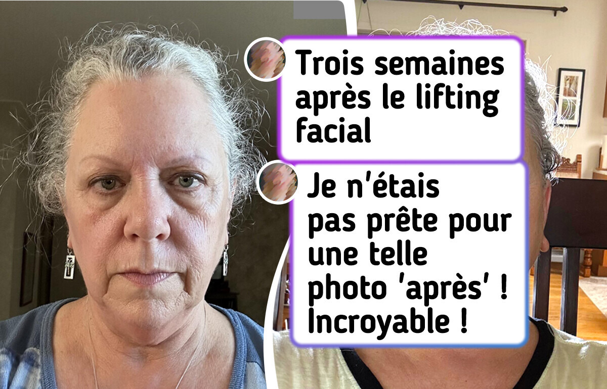 18 Femmes ont révélé des transformations à couper le souffle 18 Femmes ont révélé des transformations à couper le souffle