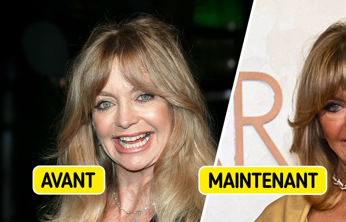 "Elle ne peut plus bouger la bouche" : Goldie Hawn méconnaissable sur le tapis rouge