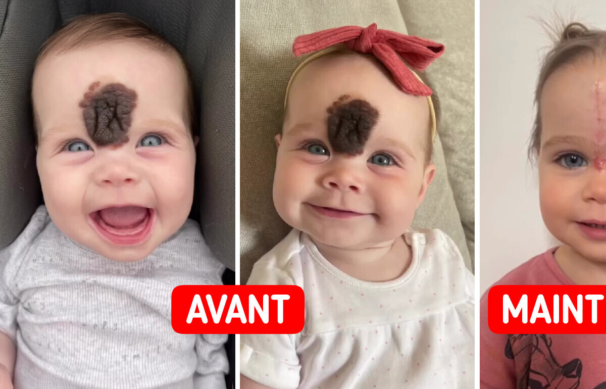 “On nous dévisageait”, cette famille a pris une décision difficile pour protéger leur fille des jugements “On nous dévisageait”, cette famille a pris une décision difficile pour protéger leur fille des jugements