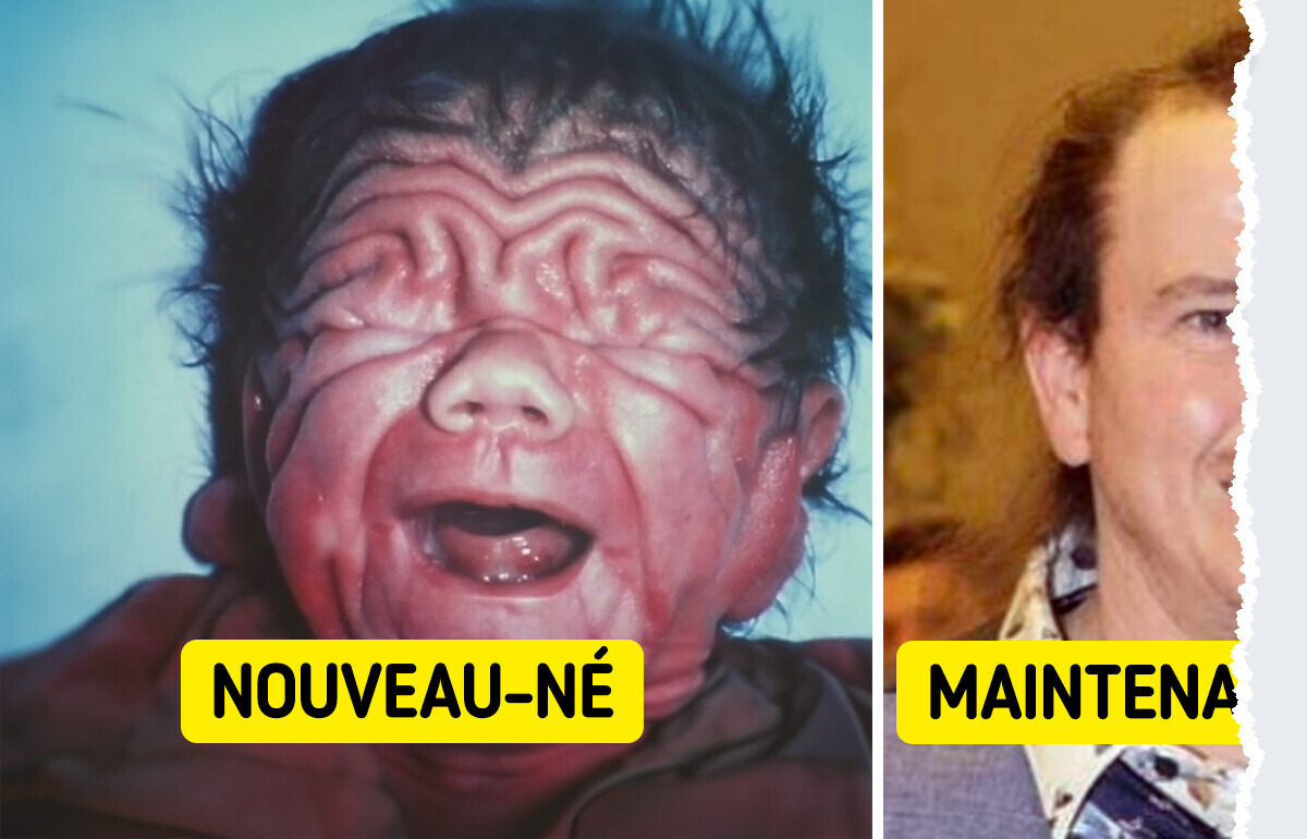 L’histoire du bébé qui a défié le destin L’histoire du bébé qui a défié le destin