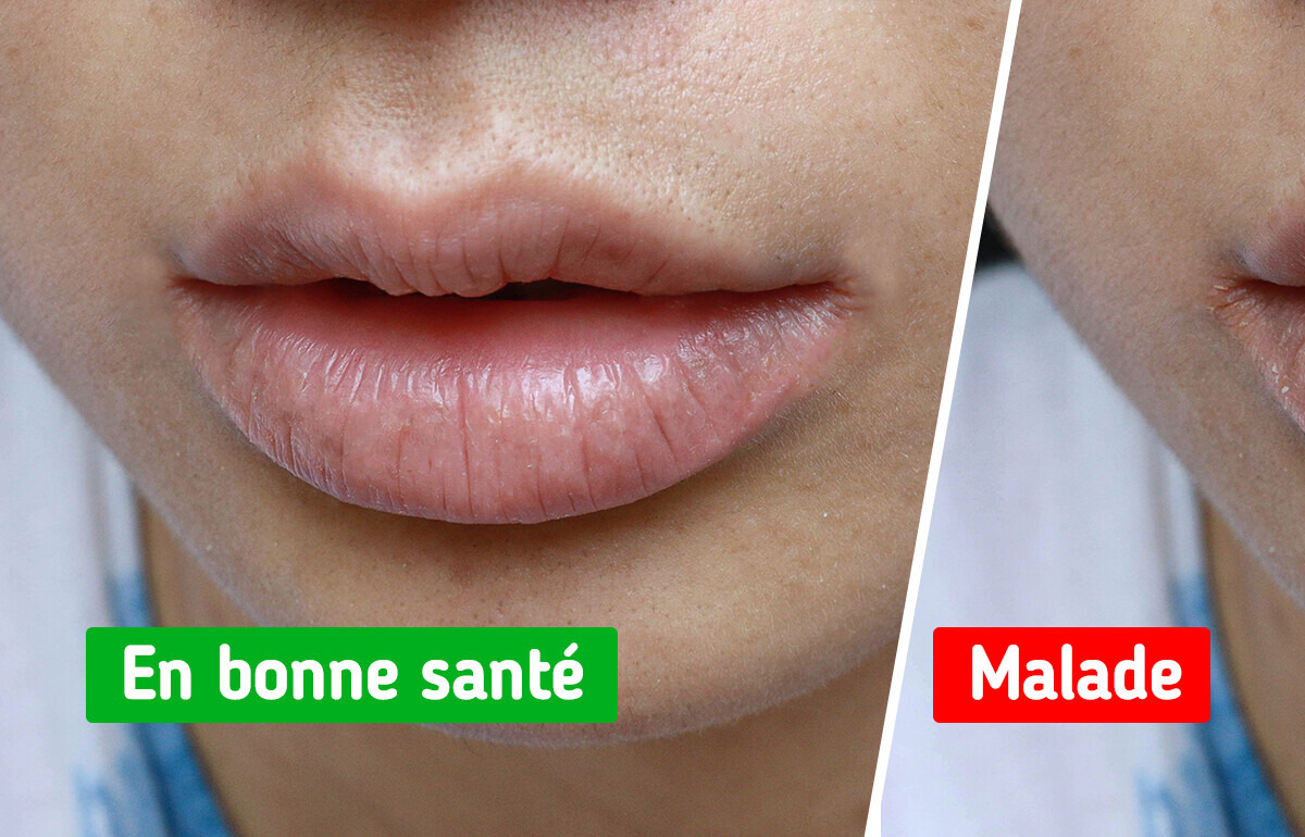 7 Signaux d’alerte que ton corps t’envoie pour te révéler d'éventuels problèmes de santé 7 Signaux d’alerte que ton corps t’envoie pour te révéler d'éventuels problèmes de santé