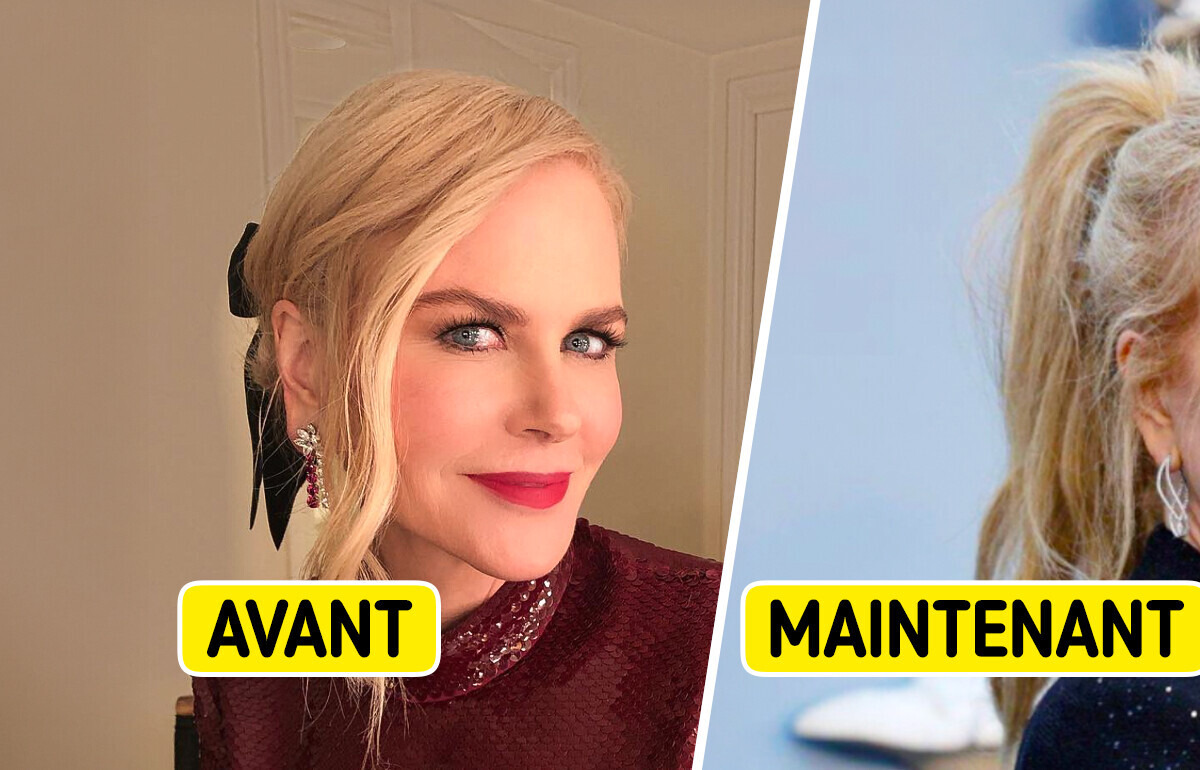 “Indices de lifting près de ses oreilles,” Nicole Kidman laisse les fans sans voix avec sa métamorphose “Indices de lifting près de ses oreilles,” Nicole Kidman laisse les fans sans voix avec sa métamorphose