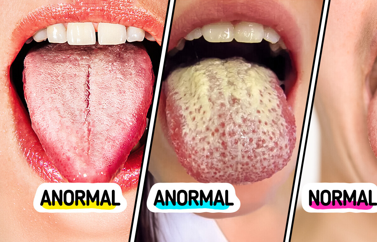 8 Méthodes efficaces pour retrouver une langue saine et rose 8 Méthodes efficaces pour retrouver une langue saine et rose