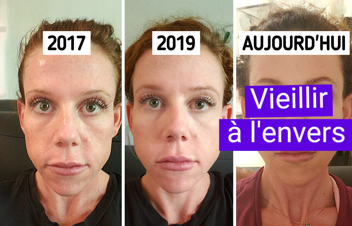 11 Personnes qui ont opté pour la chirurgie esthétique et ont décroché le jackpot