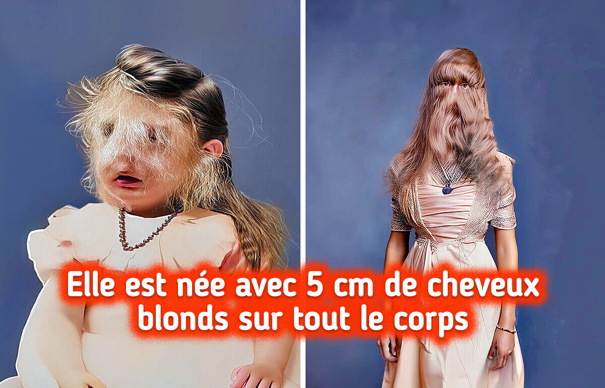 15 Photos fascinantes qui mettent en lumière les merveilles du corps humain