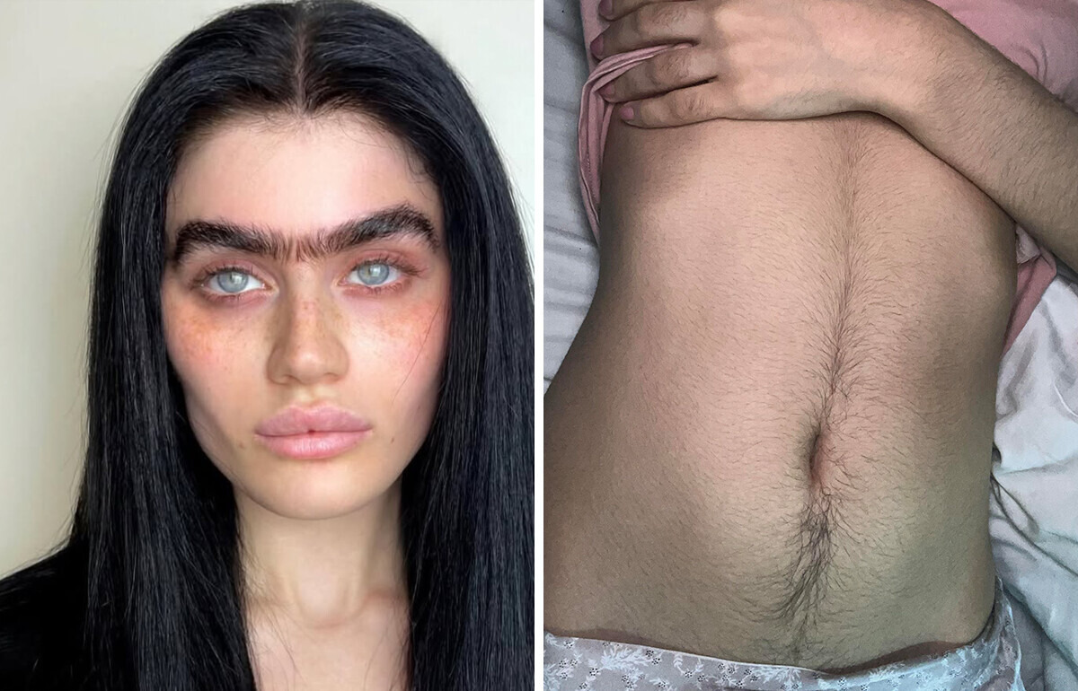 15 Femmes prouvent que les poils corporels ne sont pas à cacher