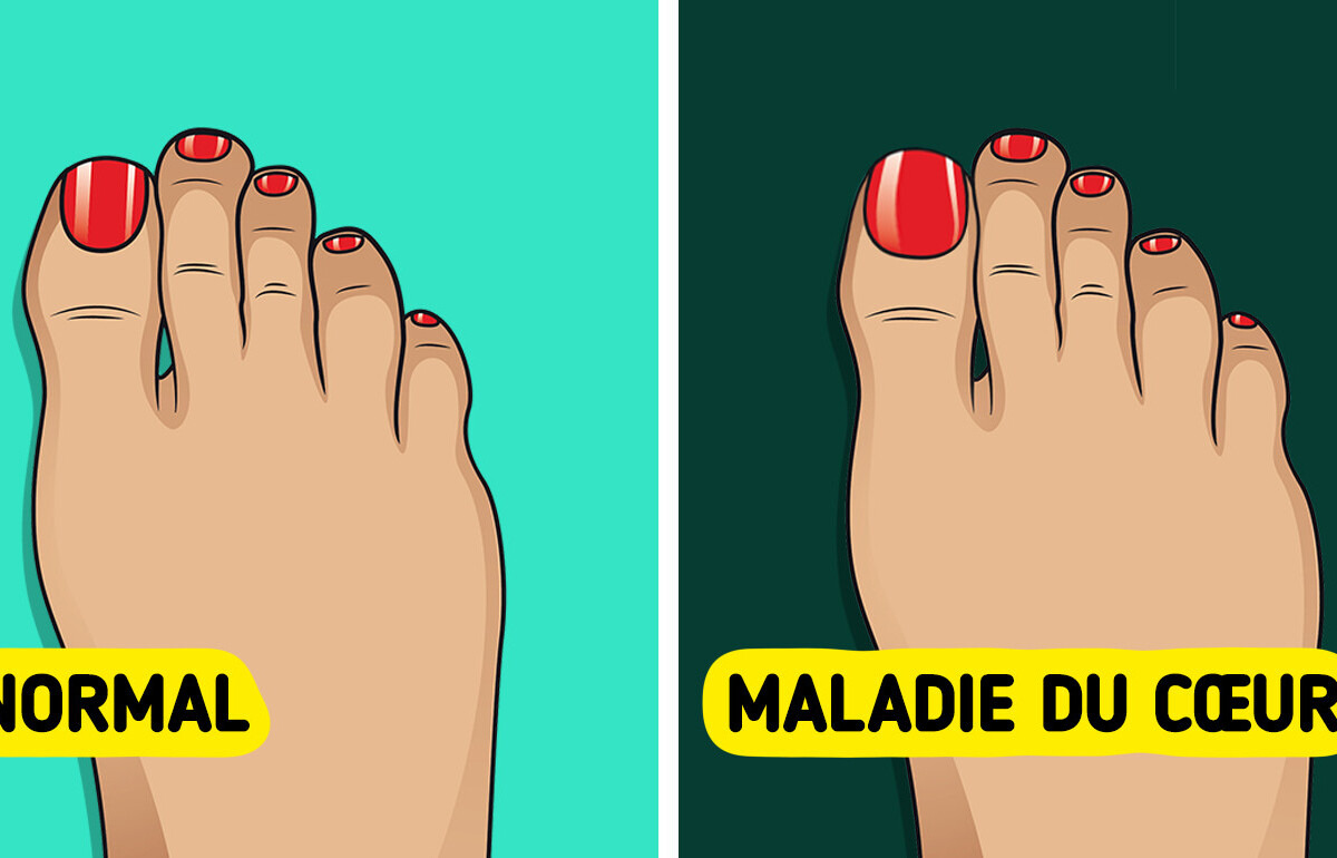 5 Secrets que tes ongles d'orteils peuvent révéler sur ton corps
