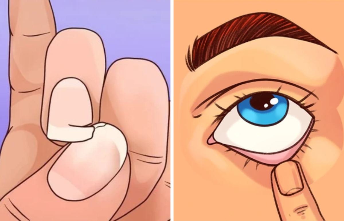 10+ Façons par lesquelles le corps montre qu’il peut manquer de fer