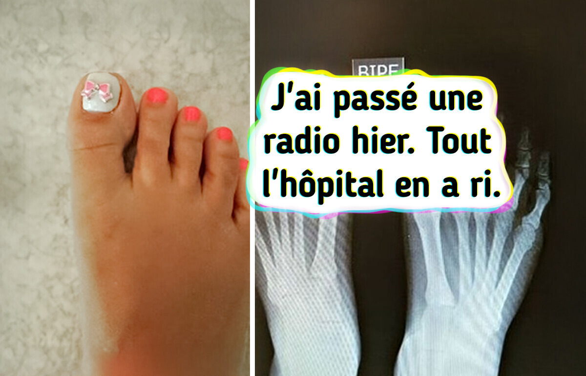 14 Images par rayons X qui éclairent notre monde sous un jour inattendu 14 Images par rayons X qui éclairent notre monde sous un jour inattendu
