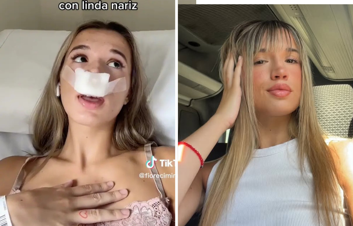 Une inflienceuse se fait refaire le nez pour que ses “futurs enfants naissent avec un joli nez”