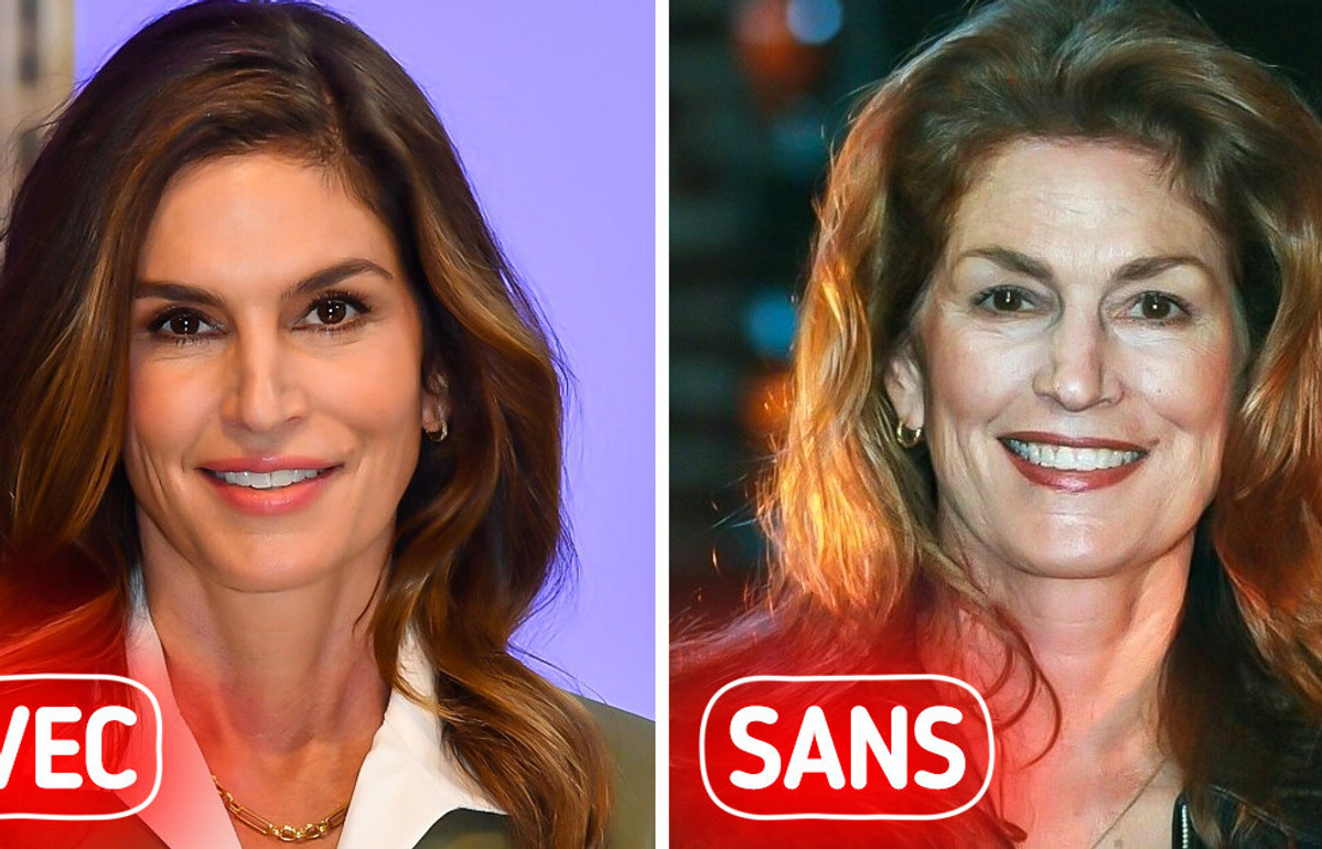 Voici à quoi ces 16 stars ressembleraient sans chirurgie esthétique Voici à quoi ces 16 stars ressembleraient sans chirurgie esthétique